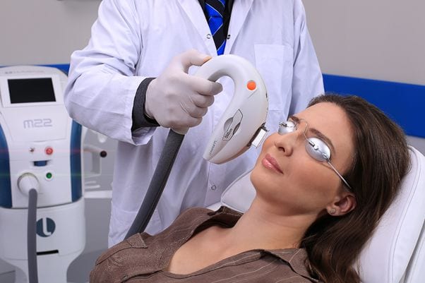 IPL treatment
